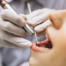 Endodoncia en Medicadentec