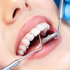 Periodoncia en Medicadentec