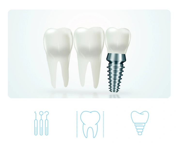 Implantes Dentales en Medicadentec