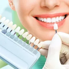 Especialidad Estética Dental