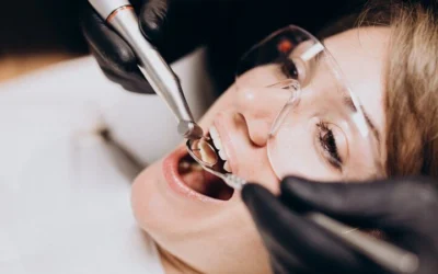 Resinas dentales, características y ventajas